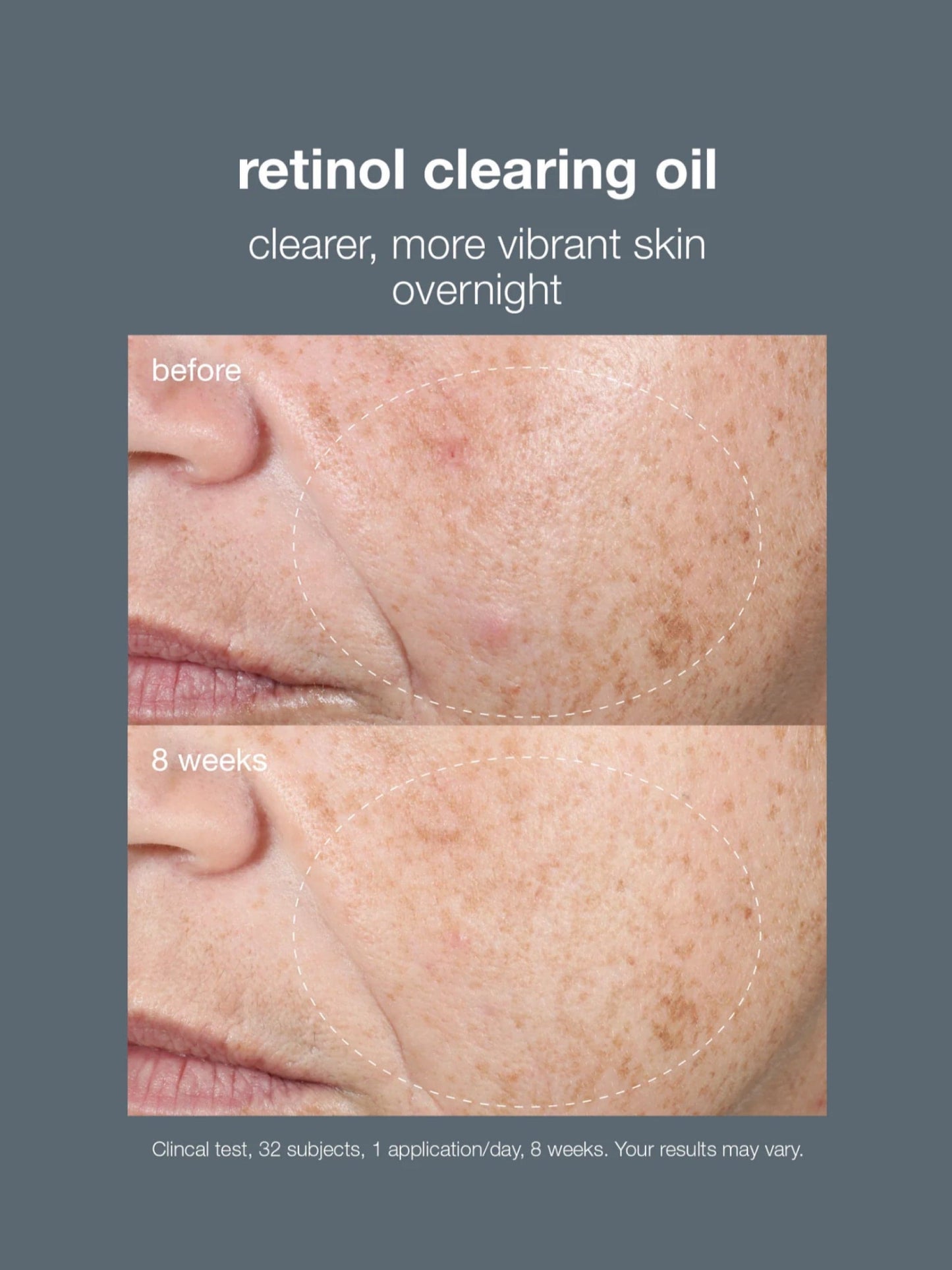 Dermalogica Retinol Clearing Oil 30ml