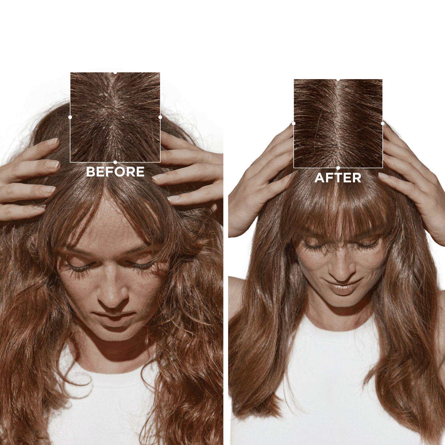 Kérastase Symbiose Cellulaire Nuit Anti-Dandruff Scalp Serum Intensif - 90ml