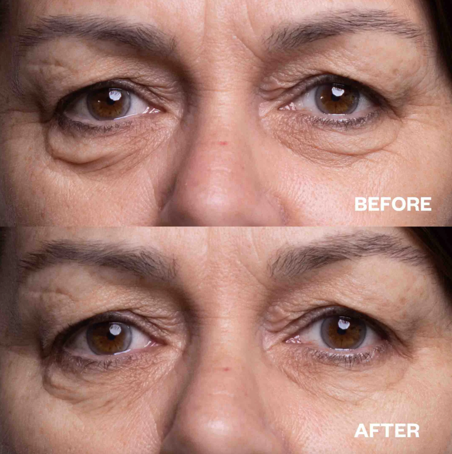 Eye Wrinkle Patches