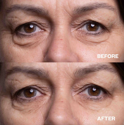 Eye Wrinkle Patches