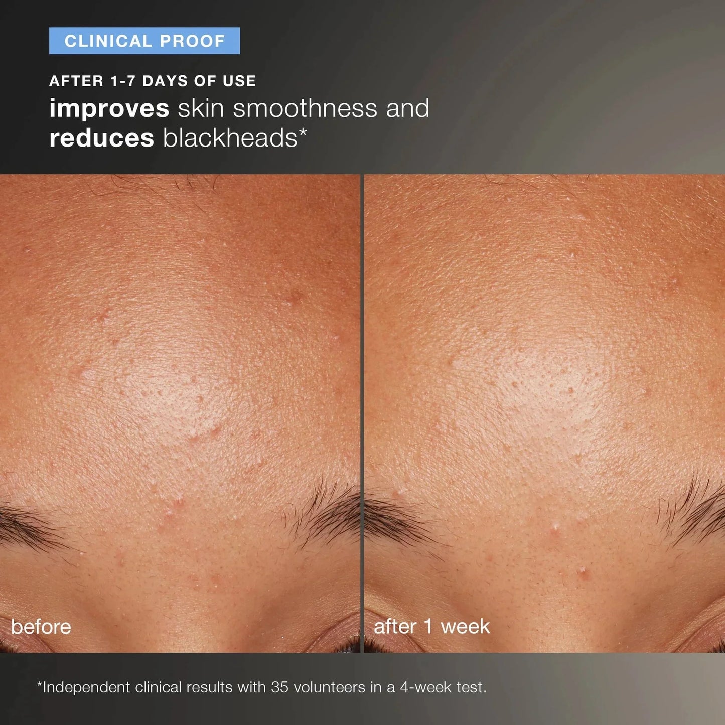Dermalogica Daily Microfoliant 74gm