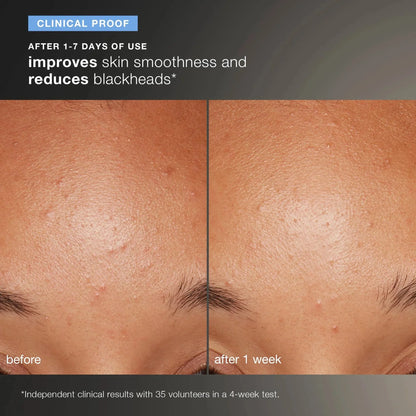 Dermalogica Daily Microfoliant 74gm
