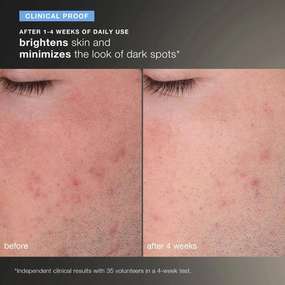 Dermalogica Daily Microfoliant 74gm